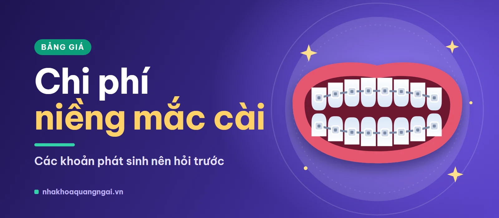 Chi phí niềng răng mắc cài: các khoản phát sinh nên hỏi trước