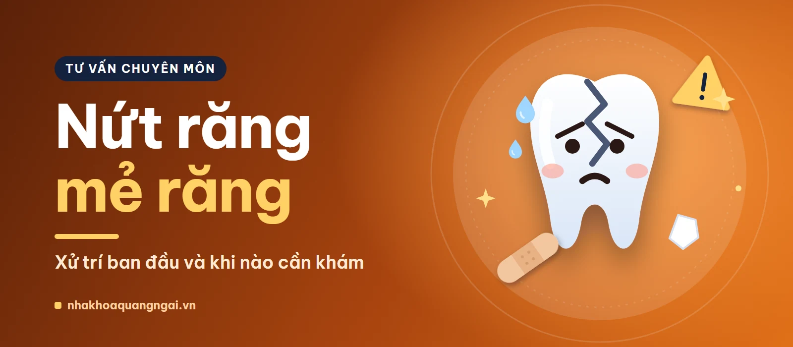 Nứt răng, mẻ răng: xử trí ban đầu và khi nào cần khám
